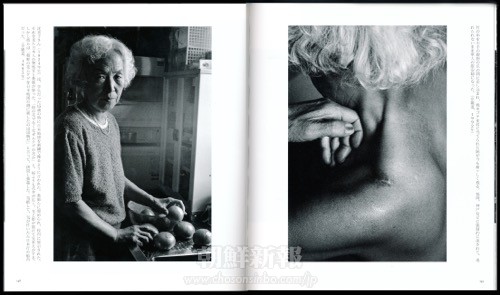 大石芳野写真集より(元「慰安婦」沈美子さんを写したもの。右ページは焼きゴテを肩に当てられた跡が今も痛々しく残る)